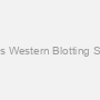 ECL Plus Western Blotting Substrate